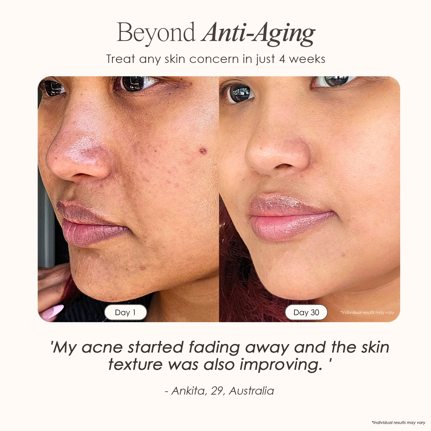 AURA ~ High Frequency Wand